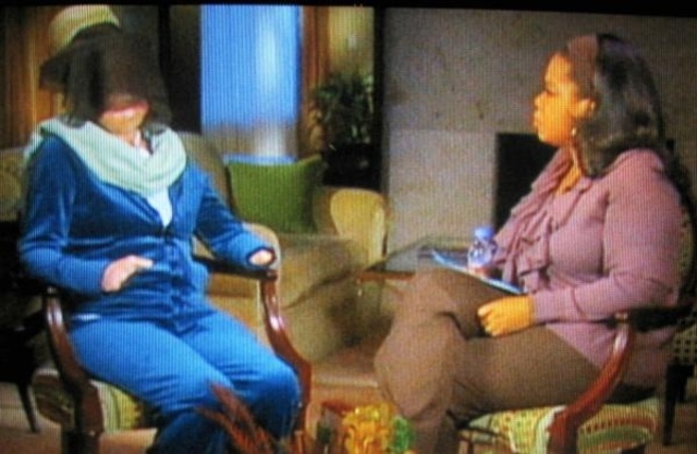 Woman Attacked By Chimp Finally Reveals Face