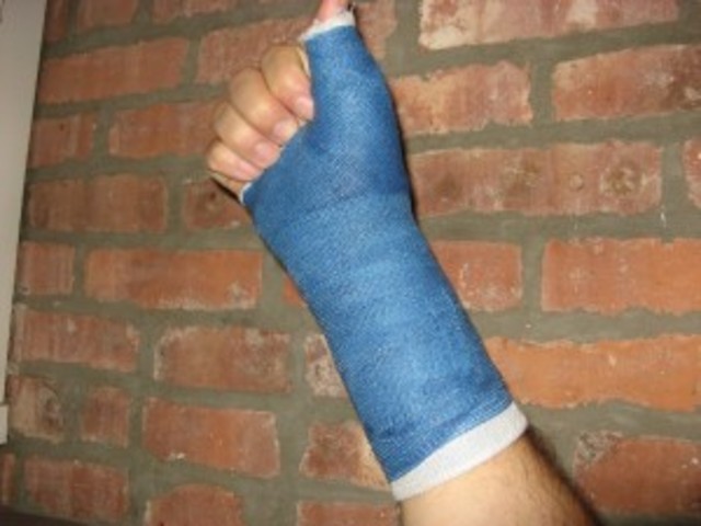 Broken Wrists