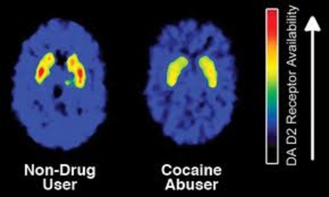 Researched the drug cocaine and its effects
