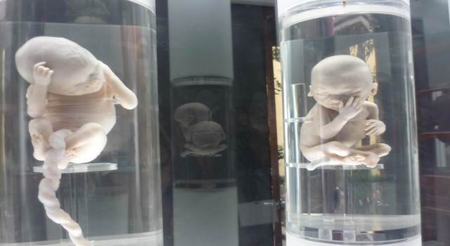 fetos de 17 a 20 semanas