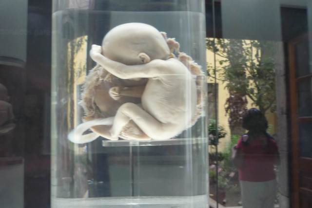 Fetos 26 a 29 semanas