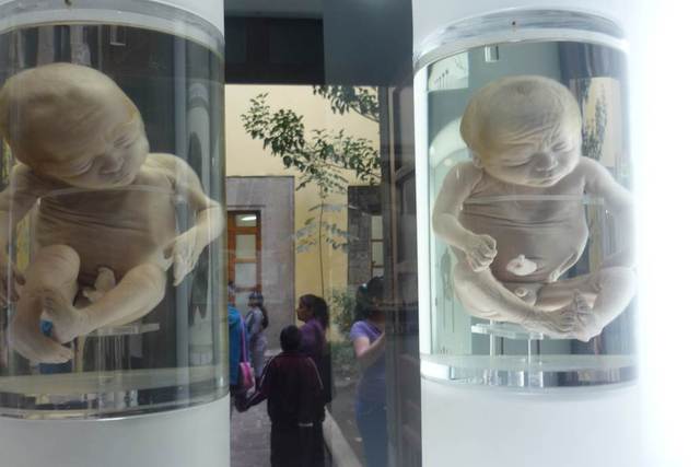 fetos de 30 a 38 semanas