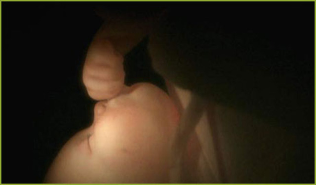 Noveno mes de gestación