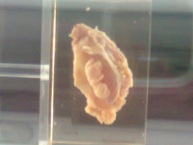 5° semana de gestacion