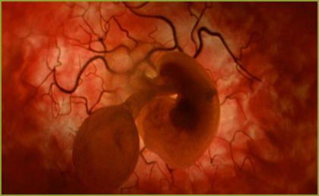 DESARROLLO FETAL: SEMANA 2 Y 3