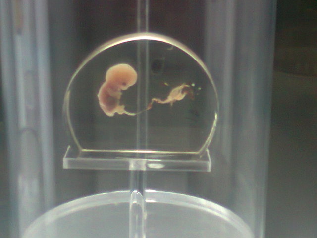 6° semana de gestacion