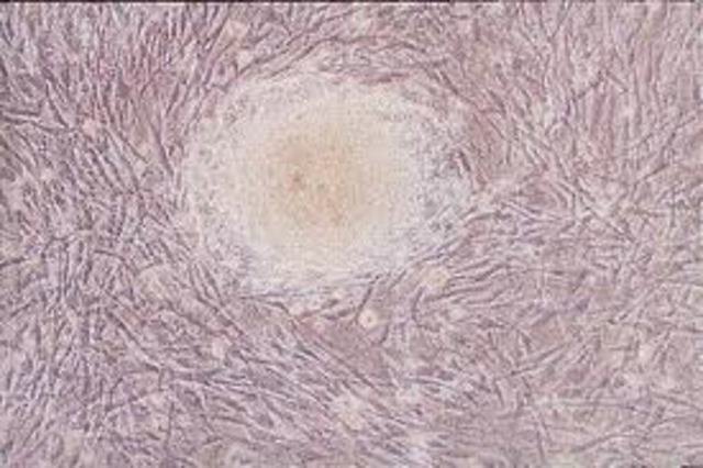 Federal Panel Approves Funding of Embryo Research