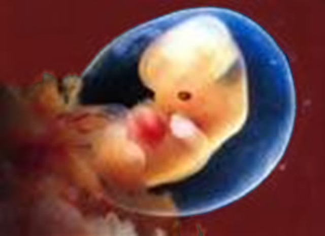 7° semana de gestacion