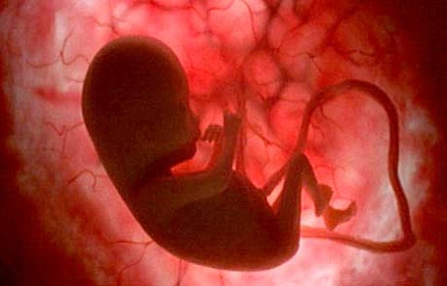 4°mes 17° semanas de gestacion