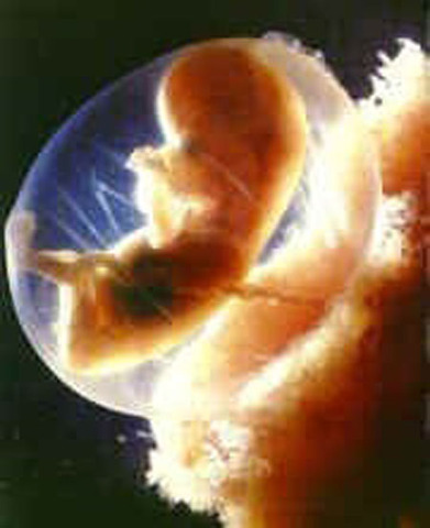 DESARROLLO FETAL: SEMANA 9