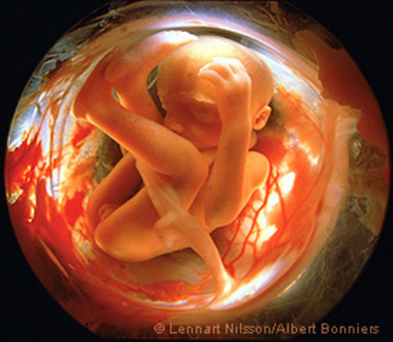 DESARROLLO FETAL: SEMANA 21 A 25