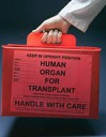 LE PREMIER TRANSPLANTE ORGANE