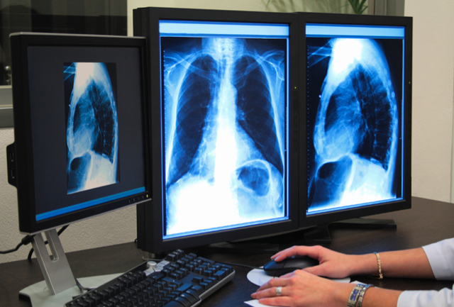 Cognitive Development