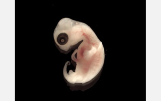 Embryo develops