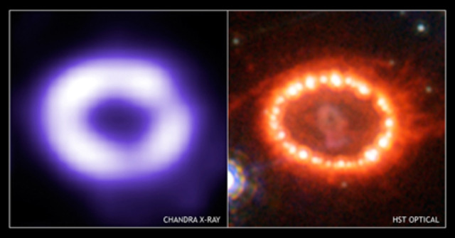 SN1987A
