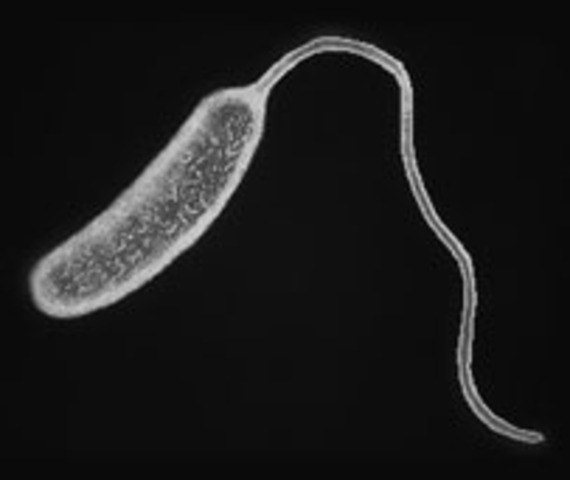 Tesla Contracts Cholera