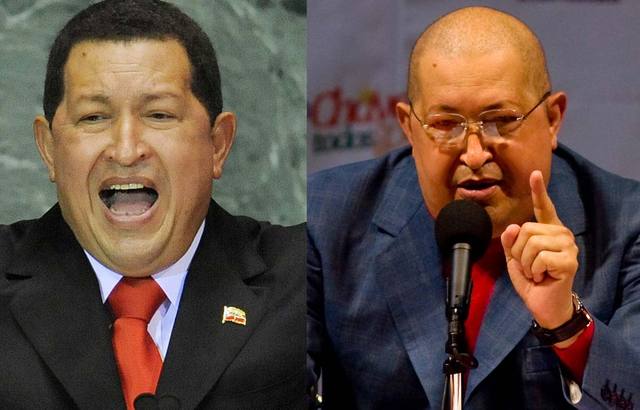 Aparición con el pelo rapado