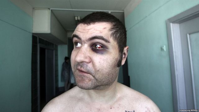 Зьбіты Алег Моўчан