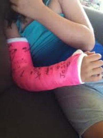 The Day I Broke My Arm
