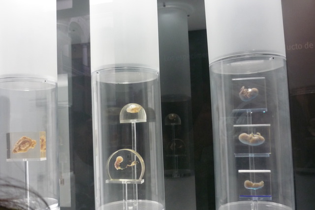 embrion de 4 a 5 semanas