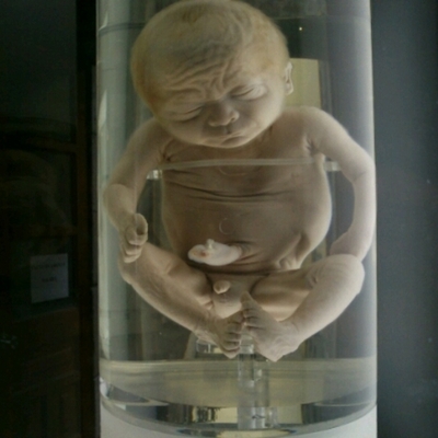 Timeline: etapas del desarrollo embrionario y fetal