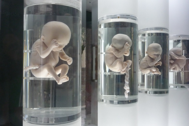 fetos de 15 a 16 semanas