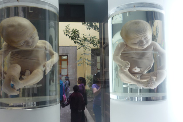 Noveno y décimo mes