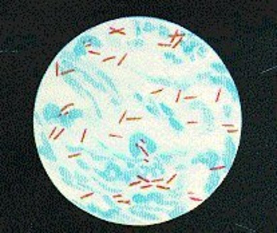 KOCH, bacil de la tuberculosi