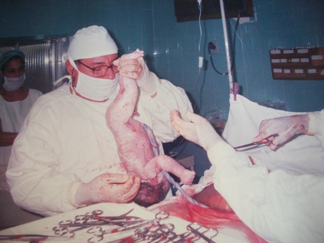 Breno Damazio Reis Ferreira nasce