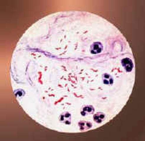 Bacil de la tuberculosi