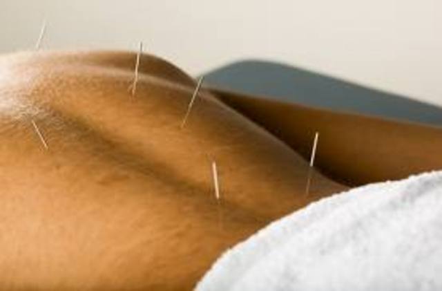 Mainstream Acupuncture