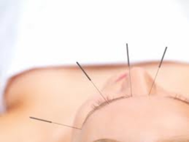 Facial Acupuncture