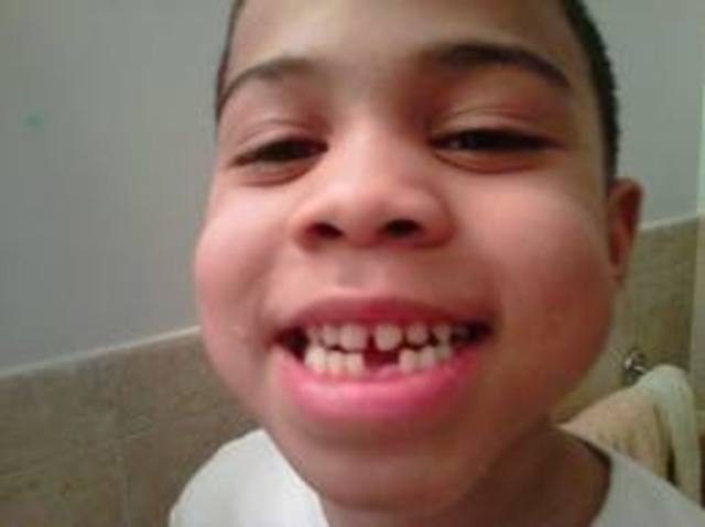 J'ai commencé à perde mes dents