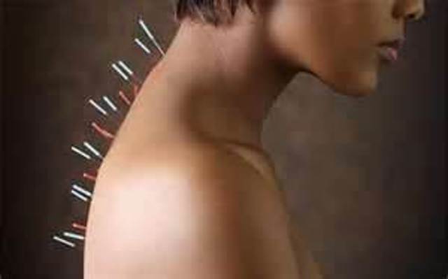 Acupunture