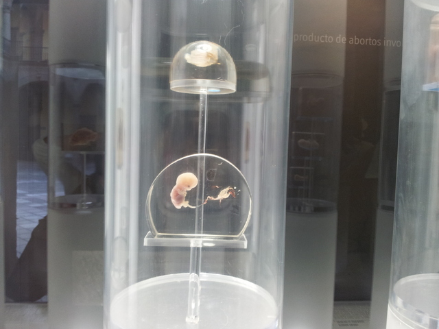 Semana 1  Ocurre la fecundación, la unión de la célula femenina con la masculina, que viajara de la Trompa de Falopio al útero donde se implantara para iniciar su desarrollo