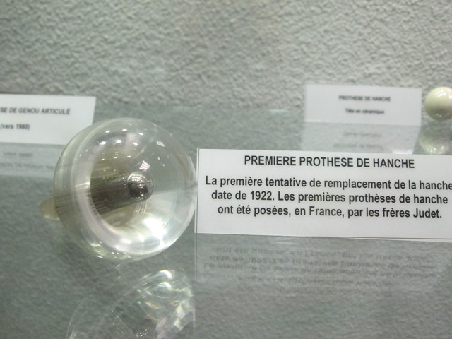 1ère prothèse de hanche