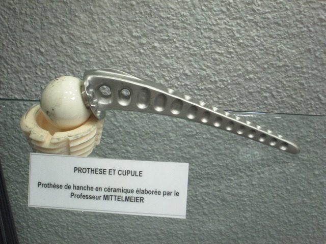 Prothèse de hanche, exemple