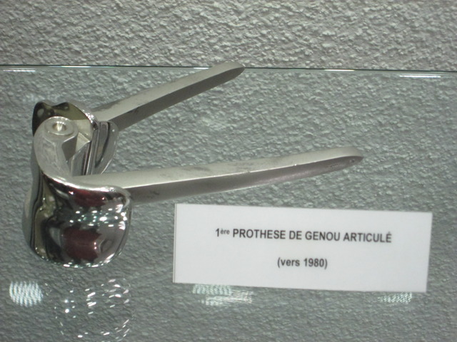 Premiere prothèse de genoux articulé