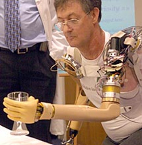 Le premier bras bionique du monde !