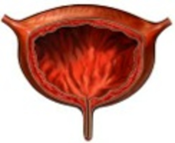 protección personal