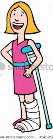 Yo rompí mi pierna.