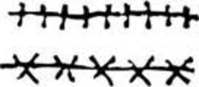 Got my first stitches in my finger