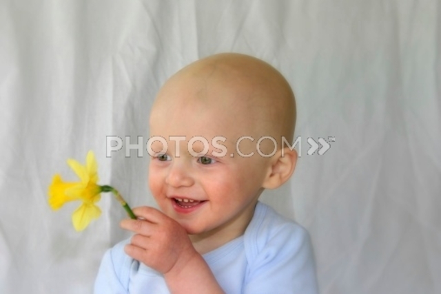 Hi - I'm Adam. You're bald