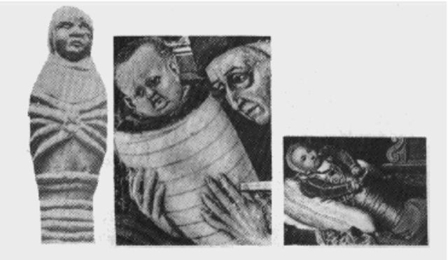 Estos niños envueltos en fajas ilustran el lento proceso en remover la empañadura