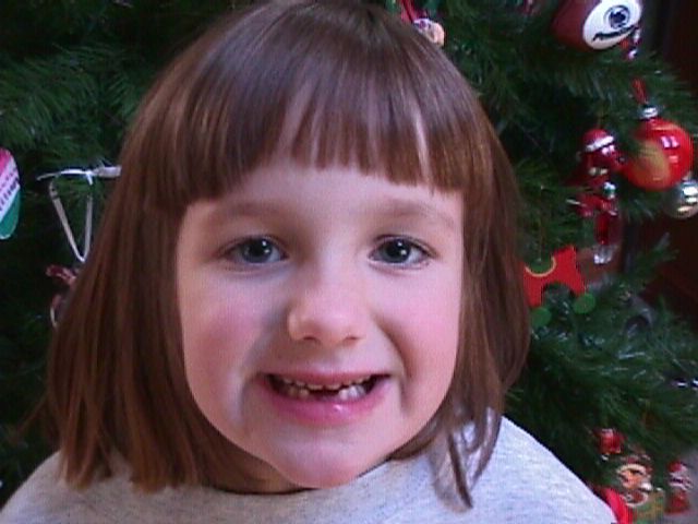 Perdí un diente por la primera vez hace once años.