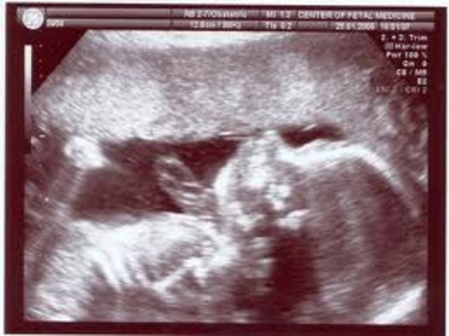 ΥΠΕΡΗΧΟΓΡΑΦΗΜΑ