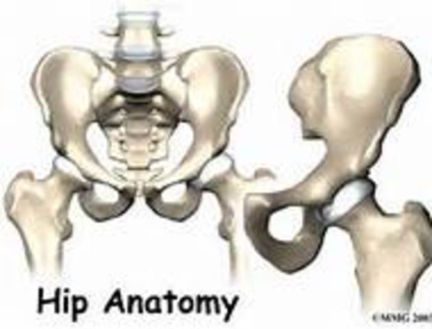 First Hip Replacement