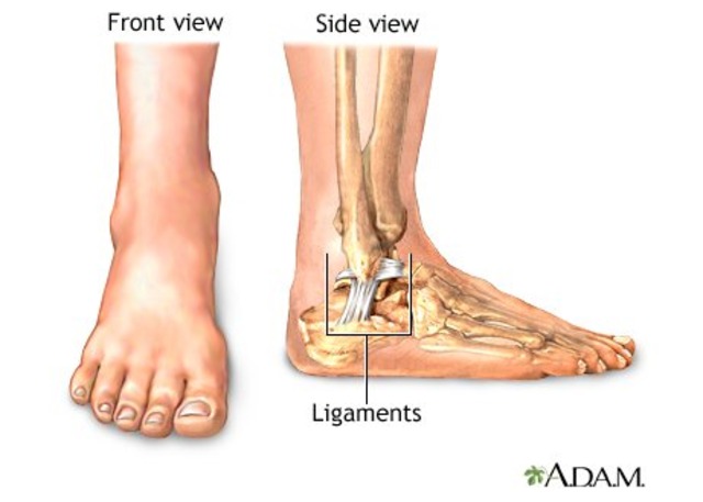 FIrst Total Ankle Replacement