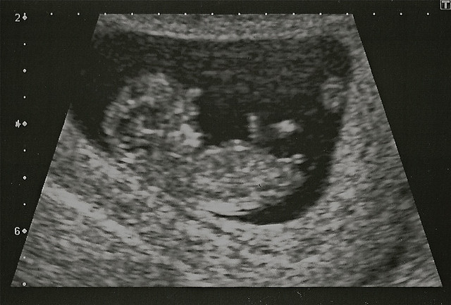 Human Fertilisation and Embryology Act 2008