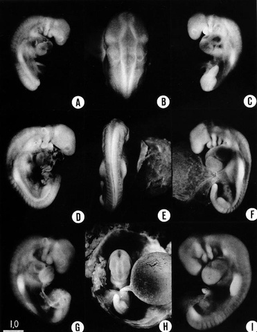 Upper and Lower limb buds.